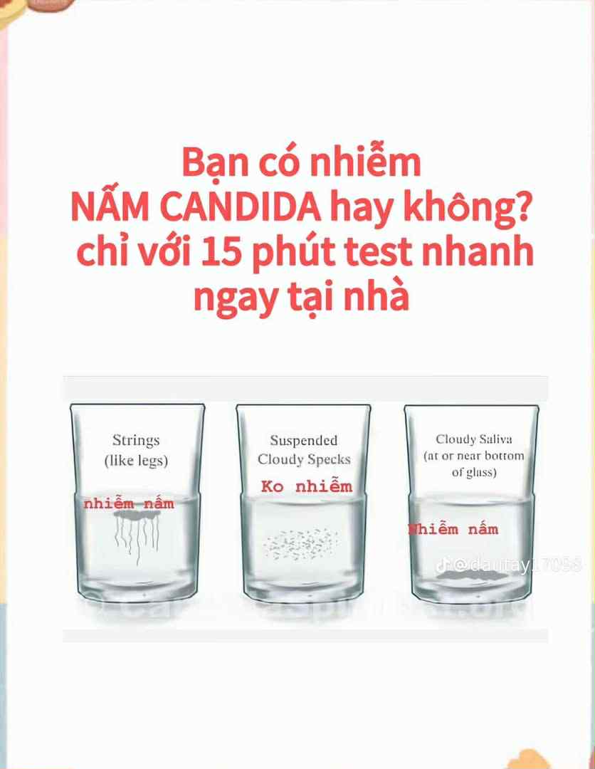 Nấm Candida và hội chứng quá tải – cách thải độc bằng dầu dừa tươi lạnh tại nhà