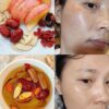 Set táo kỳ tử hoàng kỳ uống đẹp da tổng quan