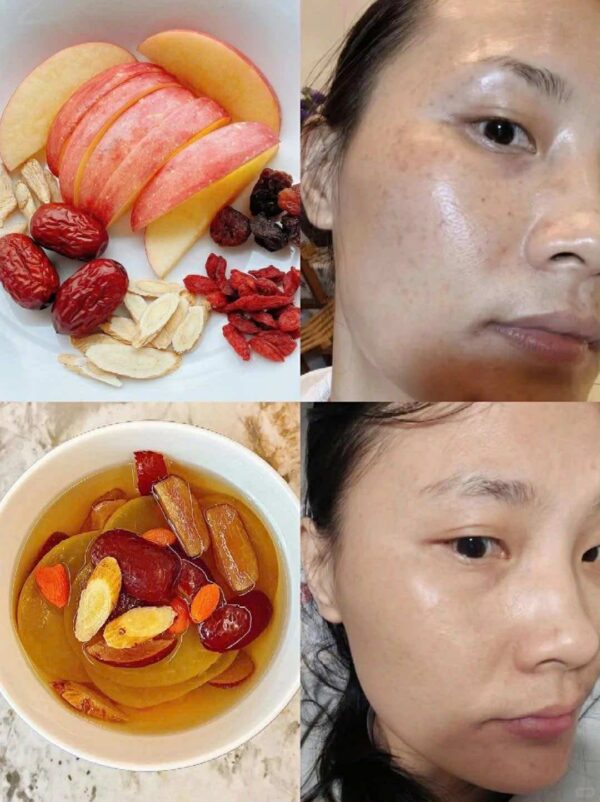 Set táo kỳ tử hoàng kỳ uống đẹp da tổng quan