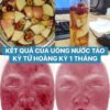SET TÁO KỲ TỬ HOÀNG KỲ UỐNG ĐẸP DA